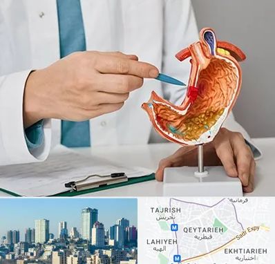 دکتر سرطان معده در قیطریه 