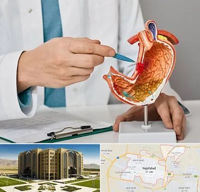 دکتر سرطان معده در نجف آباد