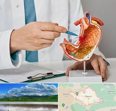 دکتر سرطان معده در مرند