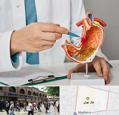 دکتر سرطان معده در بازار تهران