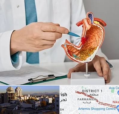 دکتر سرطان معده در فرمانیه 