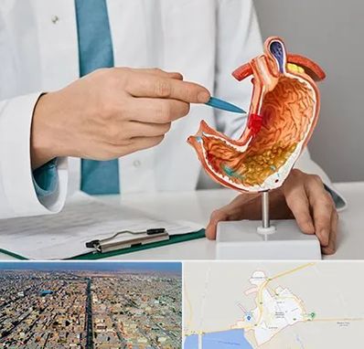 دکتر سرطان معده در بندر ماهشهر