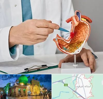 دکتر سرطان معده در آستانه اشرفیه