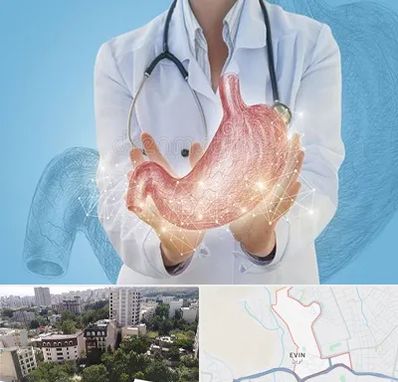 جراح سرطان معده در اوین