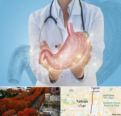 جراح سرطان معده در ولیعصر 