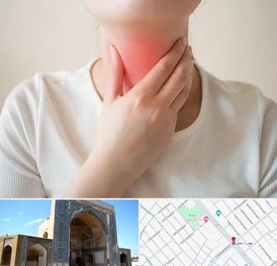 دکتر سرطان مری در مصلی مشهد