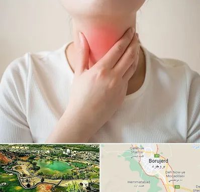 دکتر سرطان مری در بروجرد