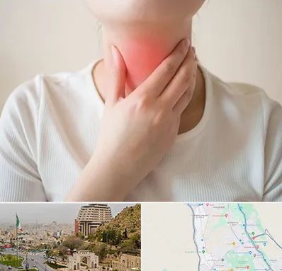 دکتر سرطان مری در فرهنگ شهر شیراز 