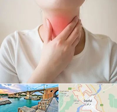 دکتر سرطان مری در دزفول