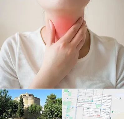 دکتر سرطان مری در مرداویج اصفهان 