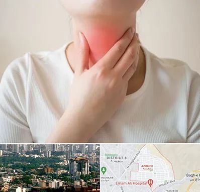 دکتر سرطان مری در عظیمیه کرج 