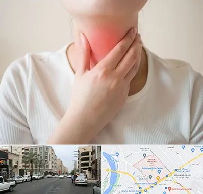 دکتر سرطان مری در زیتون کارمندی اهواز 