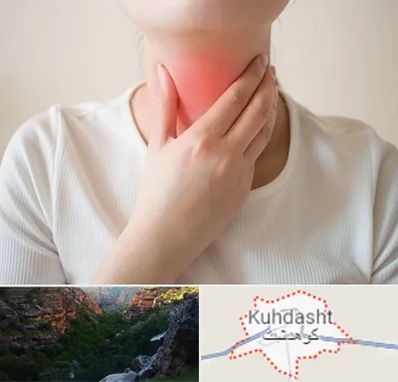 دکتر سرطان مری در کوهدشت