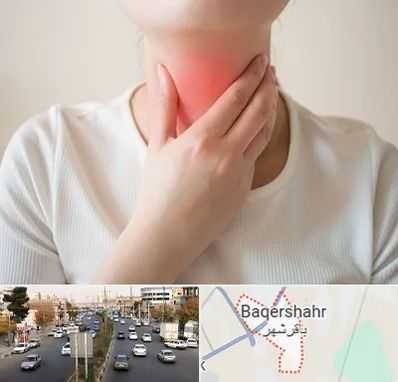 دکتر سرطان مری در باقرشهر