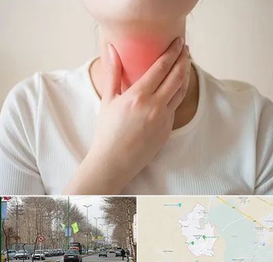 دکتر سرطان مری در نظرآباد کرج 