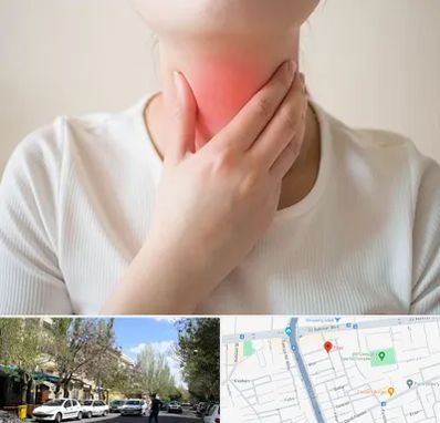 دکتر سرطان مری در کوی فیروز تبریز