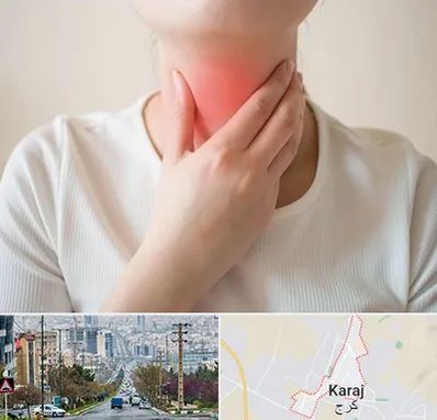 دکتر سرطان مری در گوهردشت کرج 