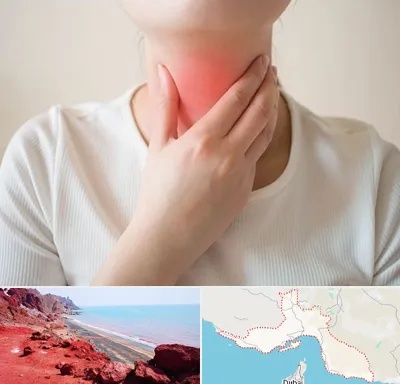 دکتر سرطان مری در هرمزگان