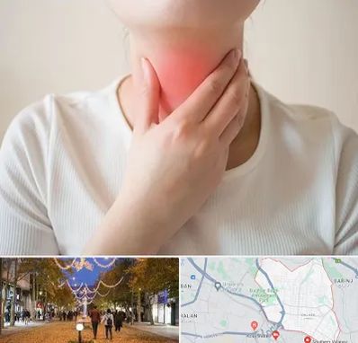 دکتر سرطان مری در ولیعصر ارومیه