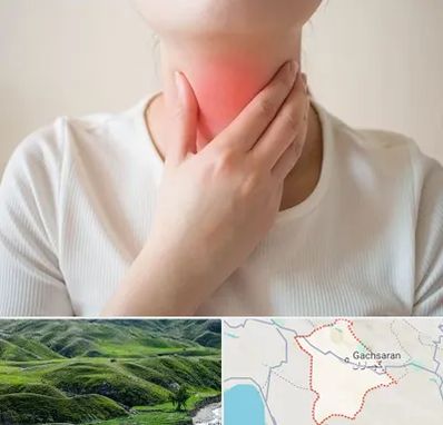 دکتر سرطان مری در گچساران