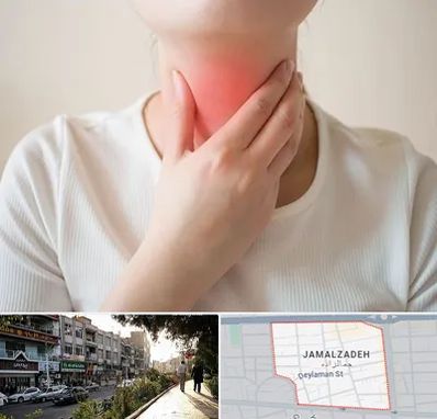 دکتر سرطان مری در خیابان جمالزاده