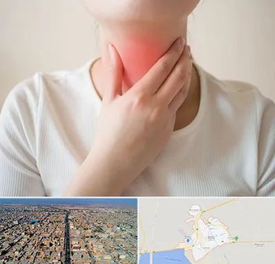 دکتر سرطان مری در بندر ماهشهر