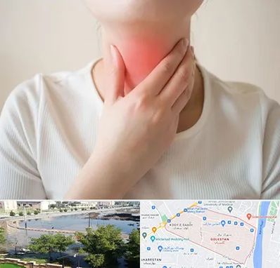 دکتر سرطان مری در گلستان اهواز 