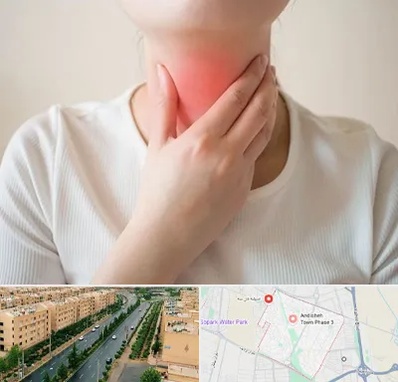 دکتر سرطان مری در فاز سه اندیشه
