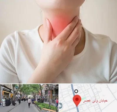 دکتر سرطان مری در ولیعصر شهریار