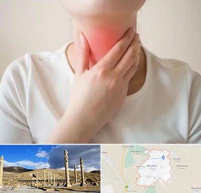 دکتر سرطان مری در مرودشت