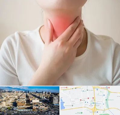 دکتر سرطان مری در شهرک راه آهن 