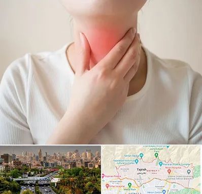 دکتر سرطان مری در منطقه 1 تهران 