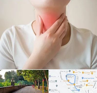 دکتر سرطان مری در فلکه گاز رشت 