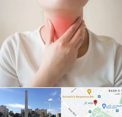 دکتر سرطان مری در فلکه گاز شیراز 