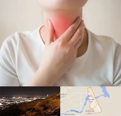 دکتر سرطان مری در میناب