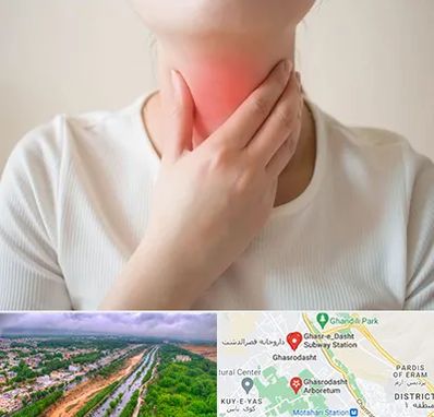 دکتر سرطان مری در قصرالدشت شیراز 