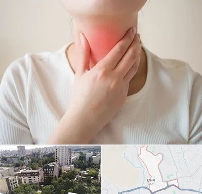 دکتر سرطان مری در اوین