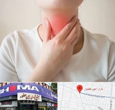 دکتر سرطان مری در امین حضور