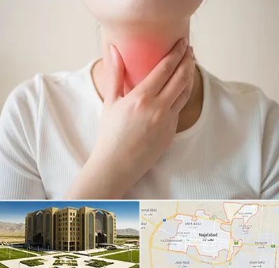 دکتر سرطان مری در نجف آباد