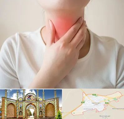 دکتر سرطان مری در سمنان