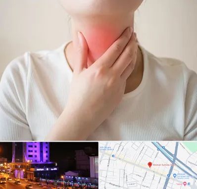 دکتر سرطان مری در آبرسان تبریز