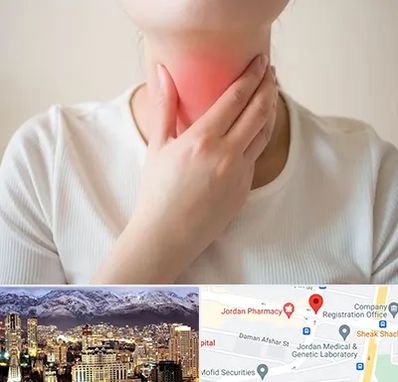 دکتر سرطان مری در جردن 