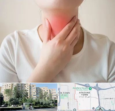 دکتر سرطان مری در آپادانا