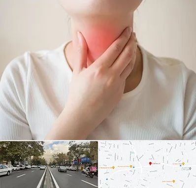 دکتر سرطان مری در دولت