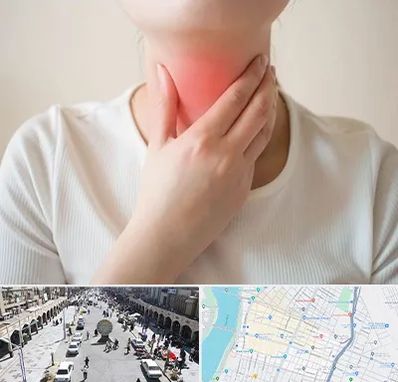 دکتر سرطان مری در نادری اهواز 