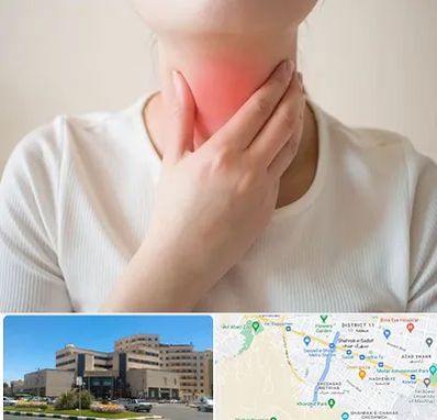 دکتر سرطان مری در صیاد شیرازی مشهد 