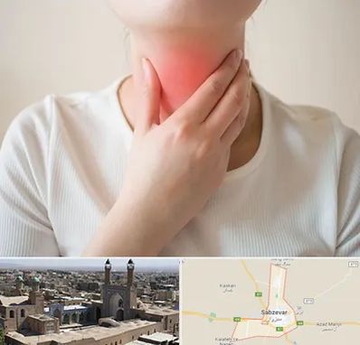 دکتر سرطان مری در سبزوار
