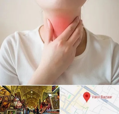 دکتر سرطان مری در بازار وکیل شیراز