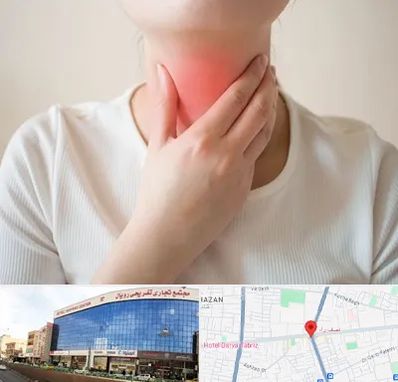 دکتر سرطان مری در نصف راه تبریز