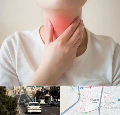 دکتر سرطان مری در خطیب تبریز